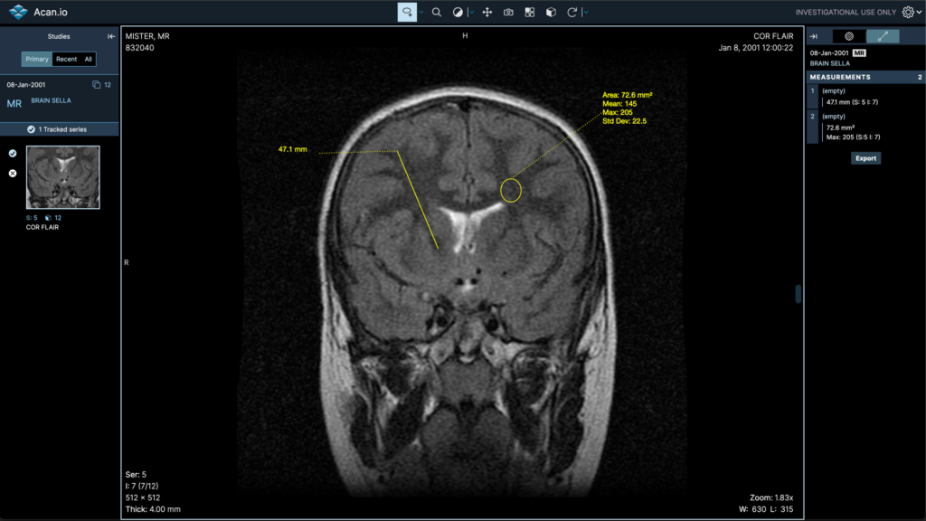 DICOM viewer iOS