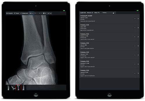 DICOM viewer iOS